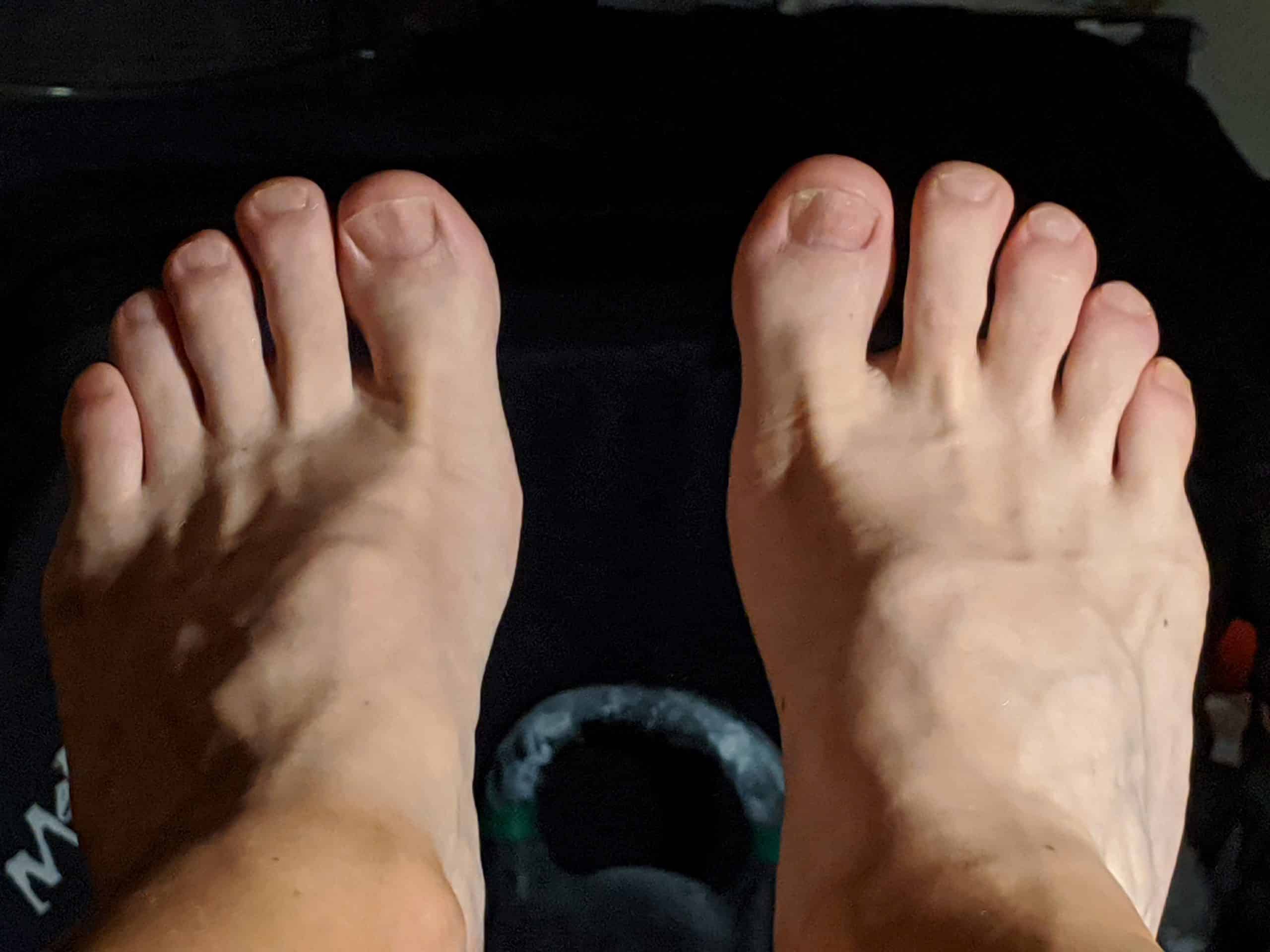 toes of morton